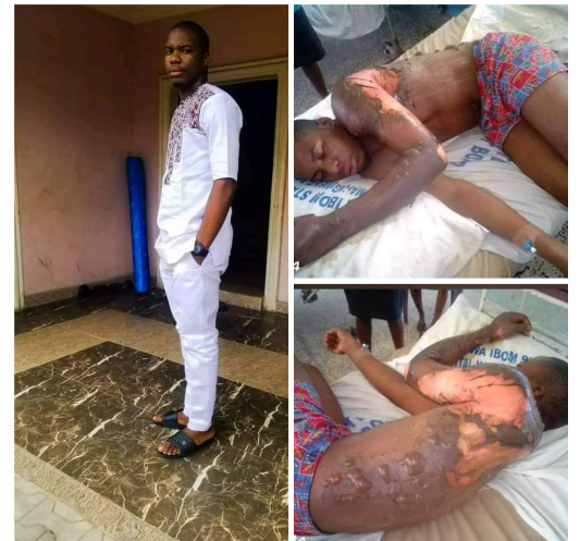 Petrol seller on the run after setting an AKSU student ablaze